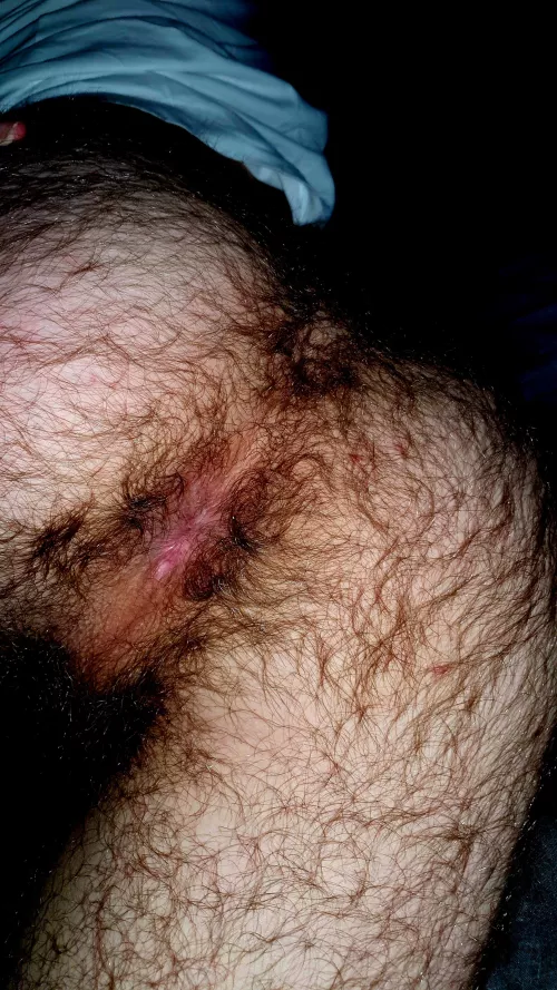 Would you put your tongue in my hairy hole?