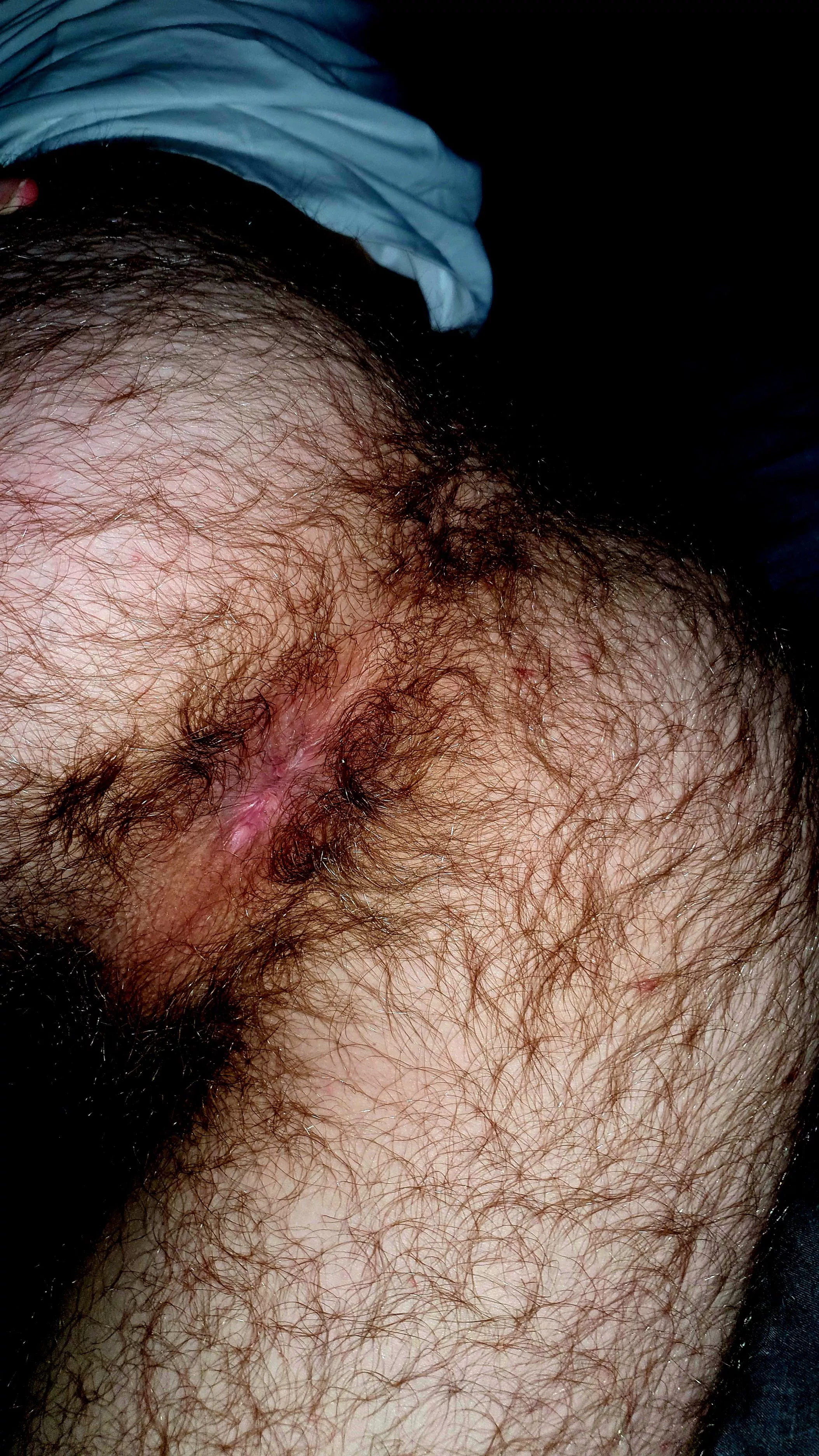 Would you put your tongue in my hairy hole?