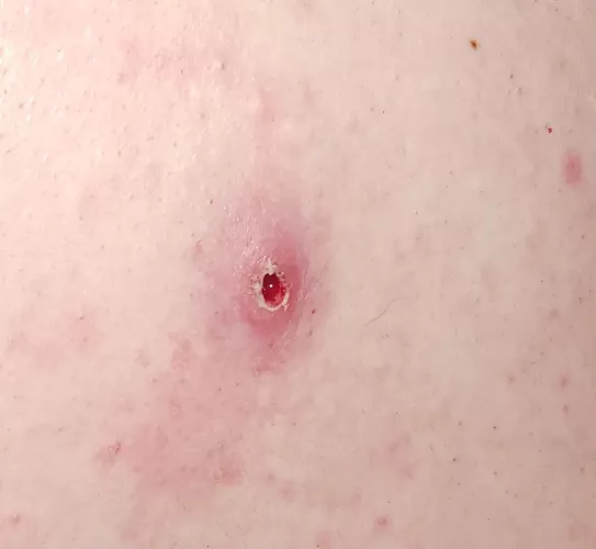 Should I be concerned??