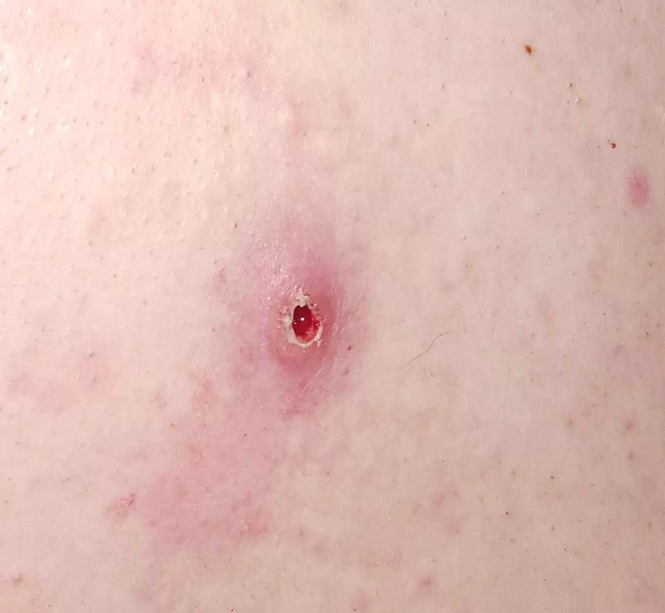 Should I be concerned??