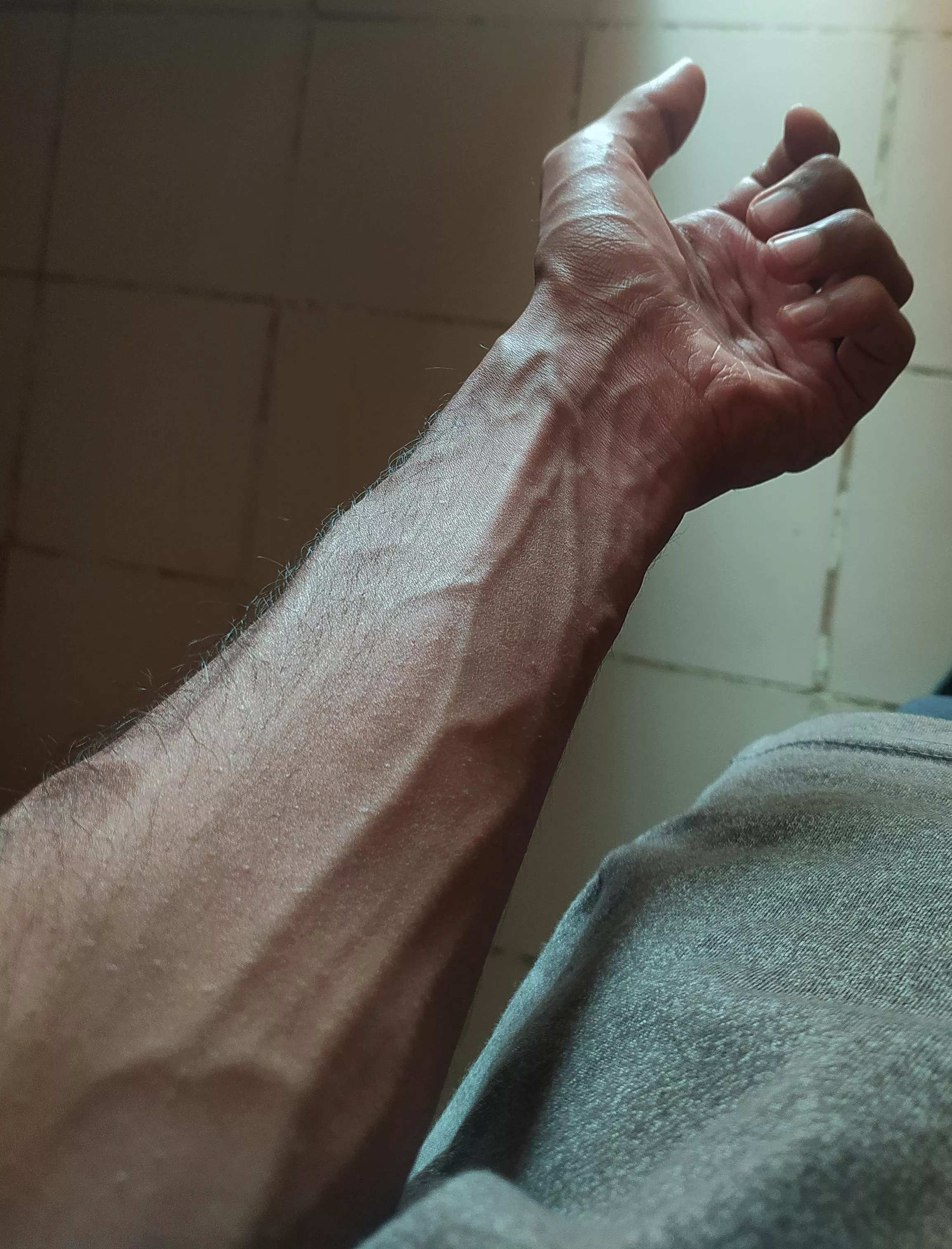 Too vascular?