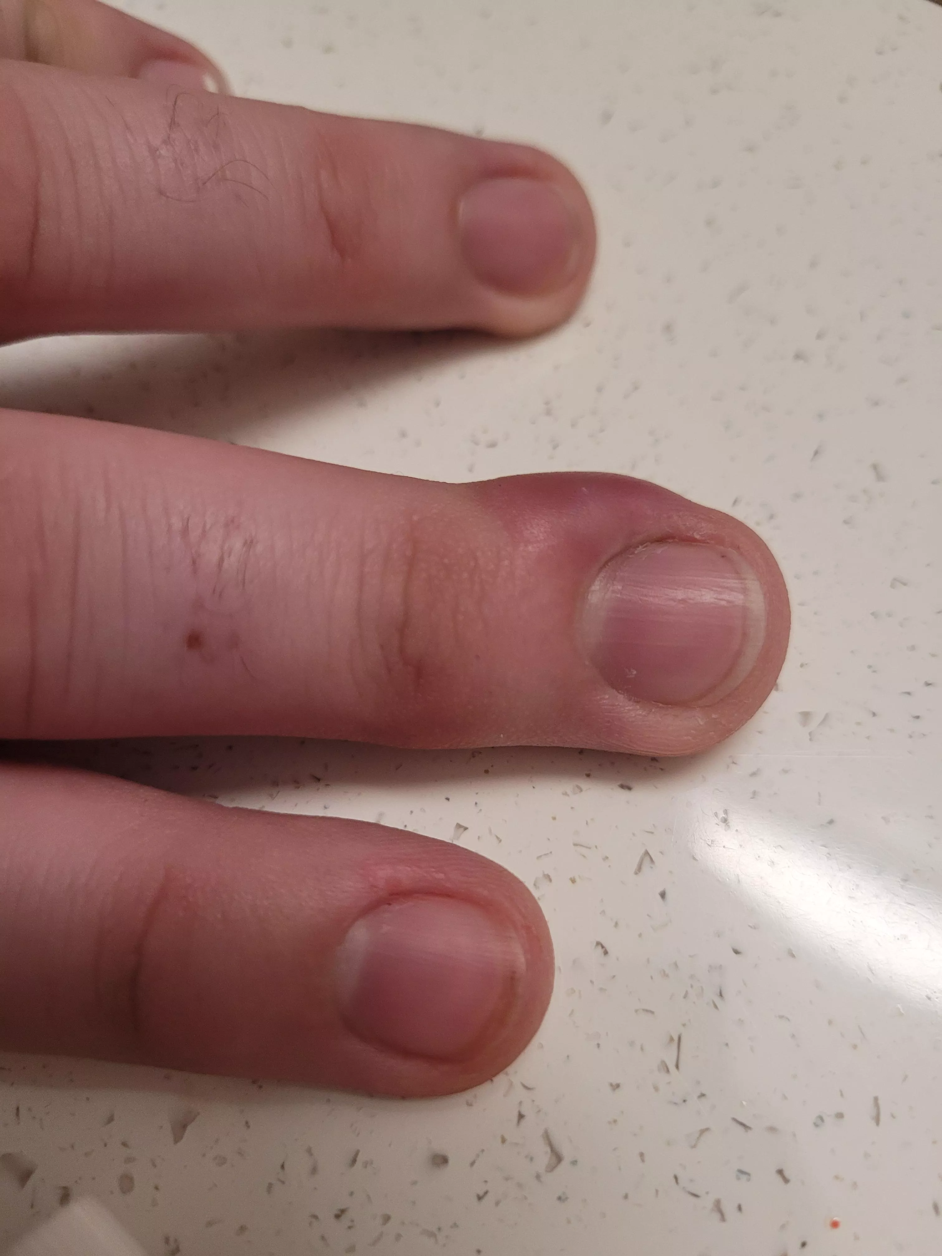 Whatever this guy is, my monkey brain wants to take an Exacto to it.