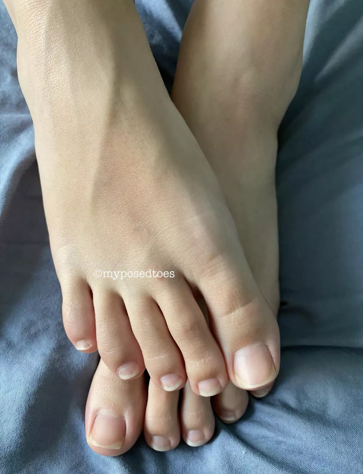 1-10 how are my natural toes?
