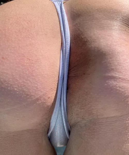 Get that sphincter some sun!