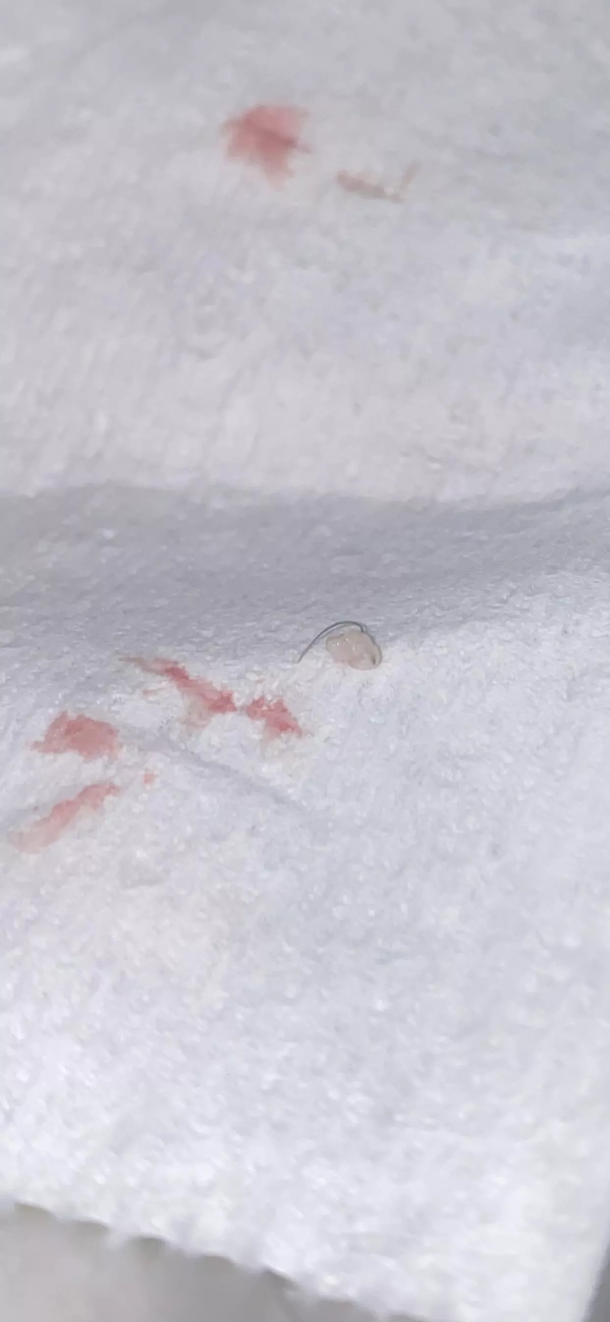 Ingrown hair randomly popped out of my labia majora on it’s own. Went to use the restroom and noticed blood on my right lip and this sucker was coming out.
