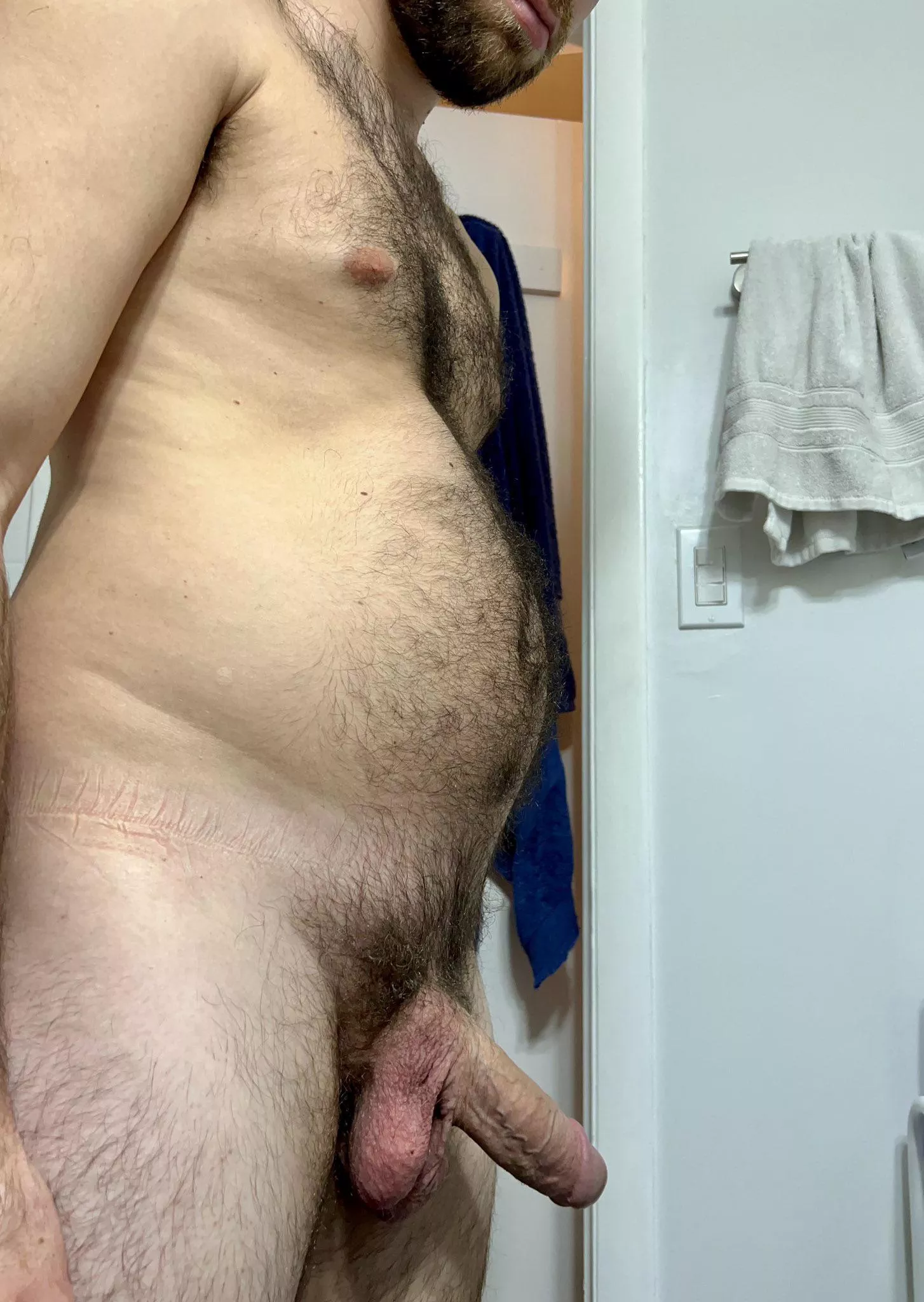 Hairy from head to toe