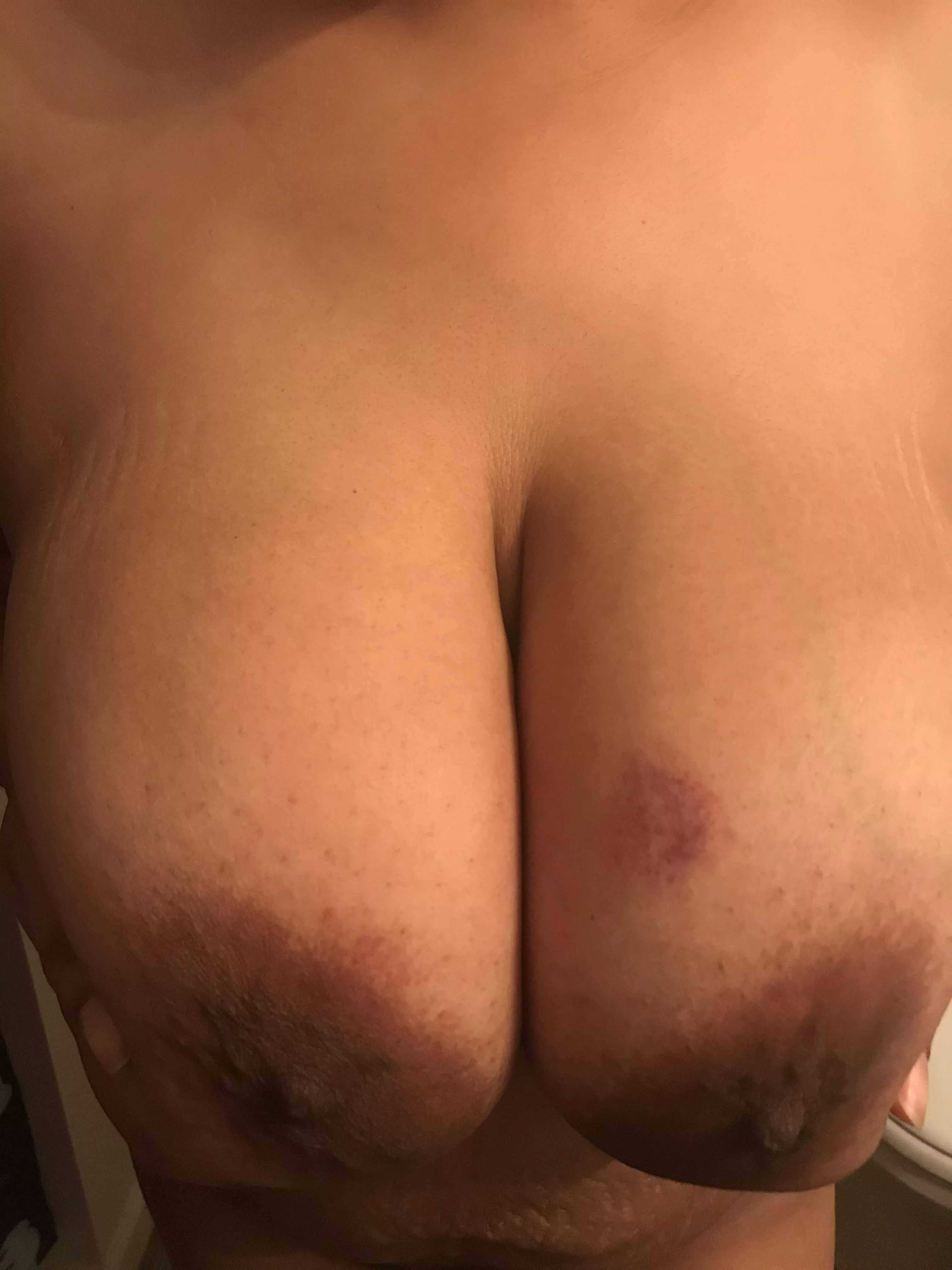 I love hickey’s 😘🥵