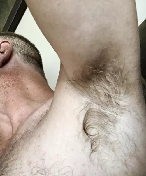 My pit hair is spreading to my back and chest…