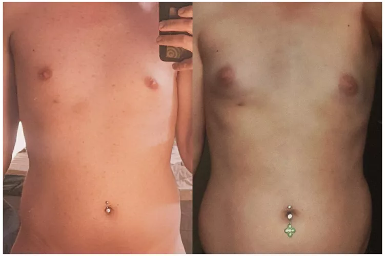 what 8 months of hormones looks like