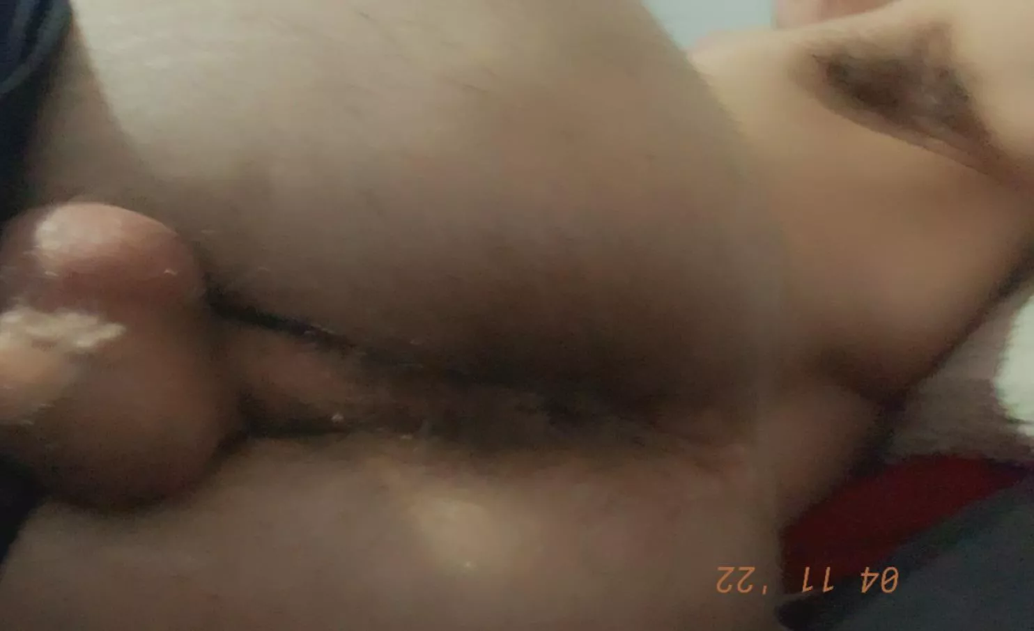 20m Growing the fur back🥵 check out that vein in my balls😈