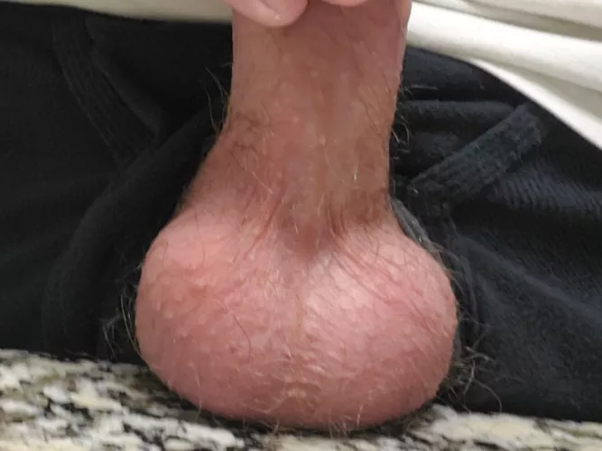 very much need drained