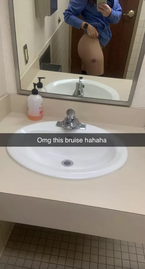 You need to stop leaving marks before he suspects something