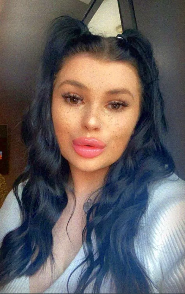 Anyone else love chavs with big fake lips? Amazing for sucking dick 🥵🥵