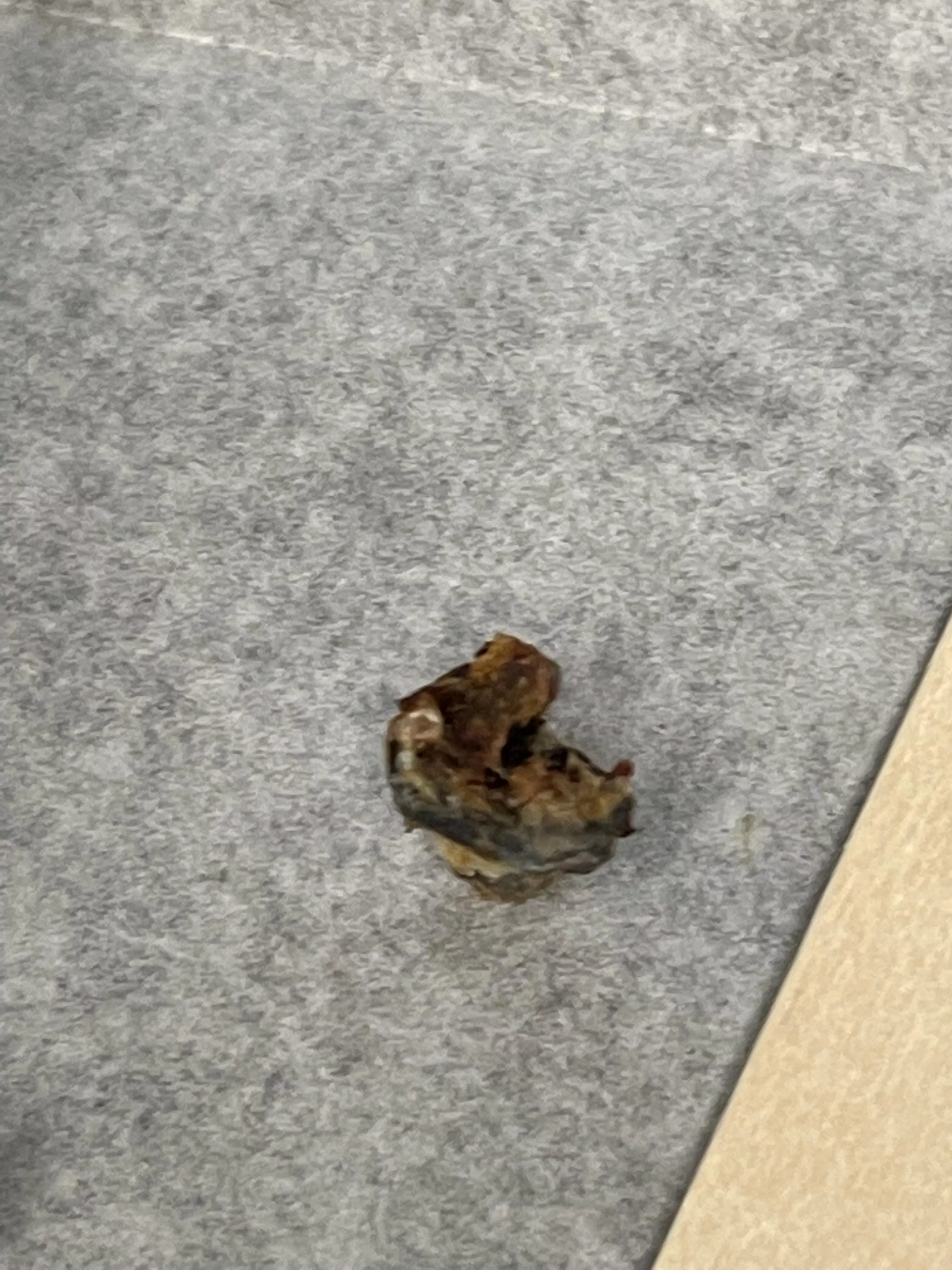 They tell you not to use Q Tips.. ENT Sucked this out and I feel like I hear everything now lol