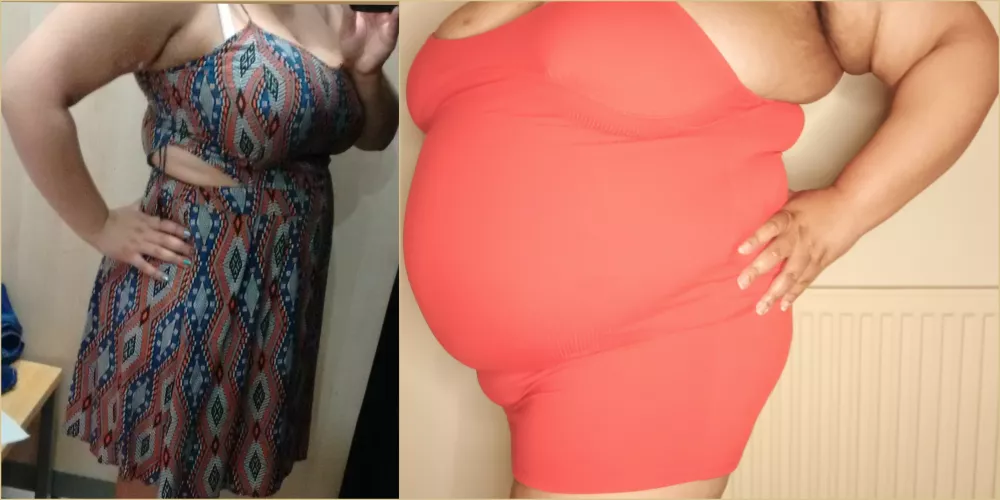 Fat enough for health issues but am I fat enough for you?