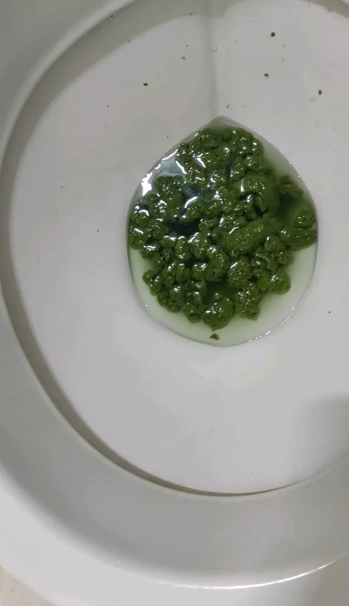 [F]very dirty my poop