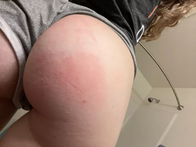 Just a faint redness