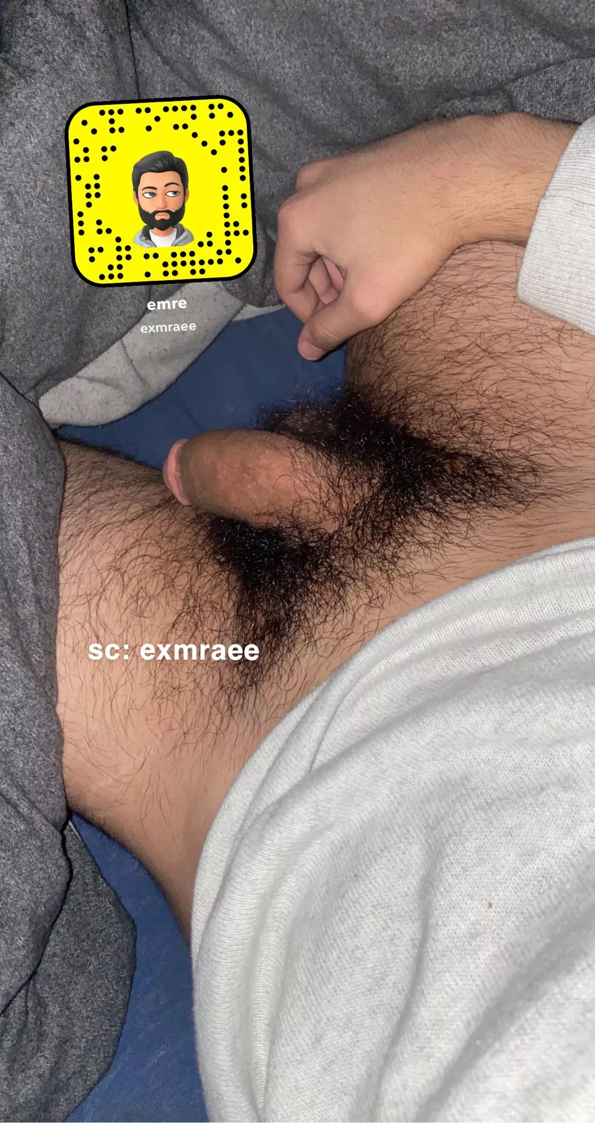 Need some help guys dm or add me if you are hairy or dominate