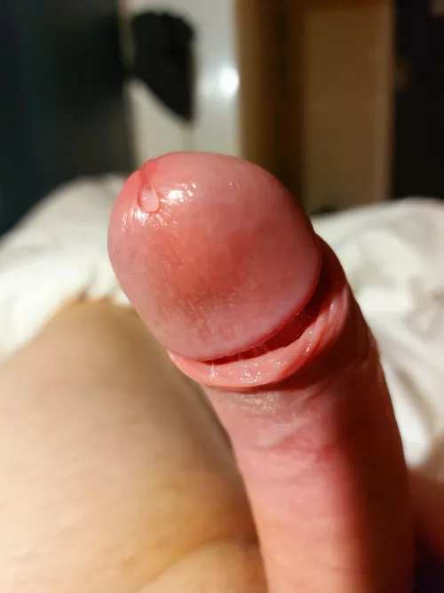 15 days and im constantly in this state, what should i do?🥺