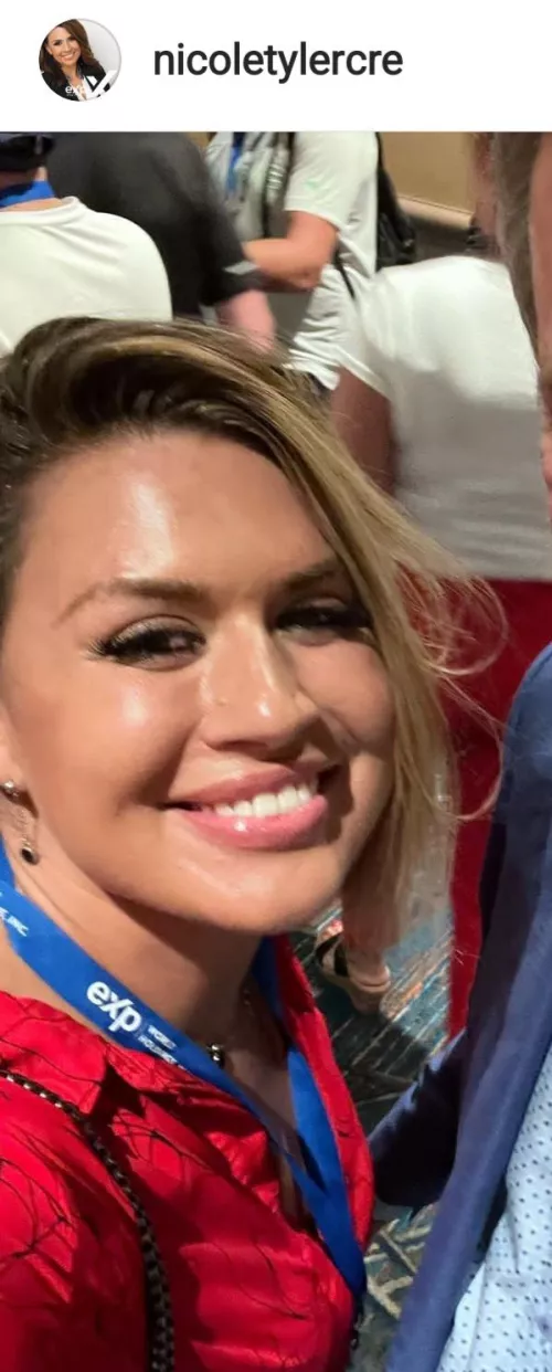 Looks like she got some facial work done.