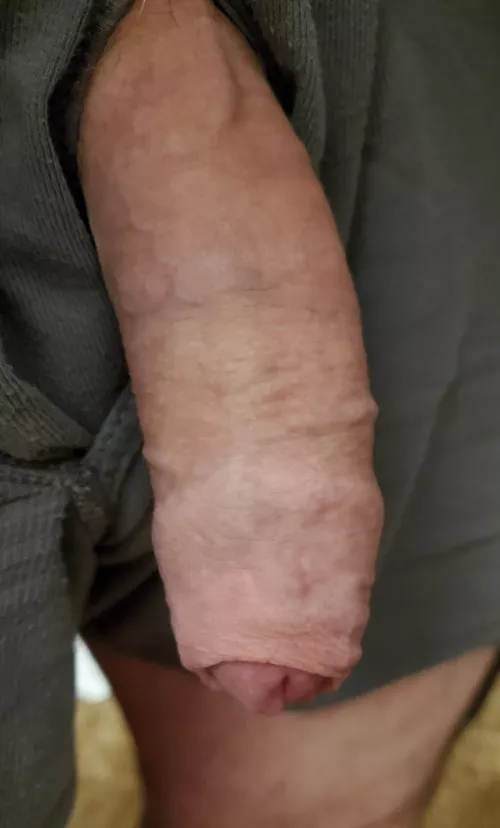 Luck the skin back for me.