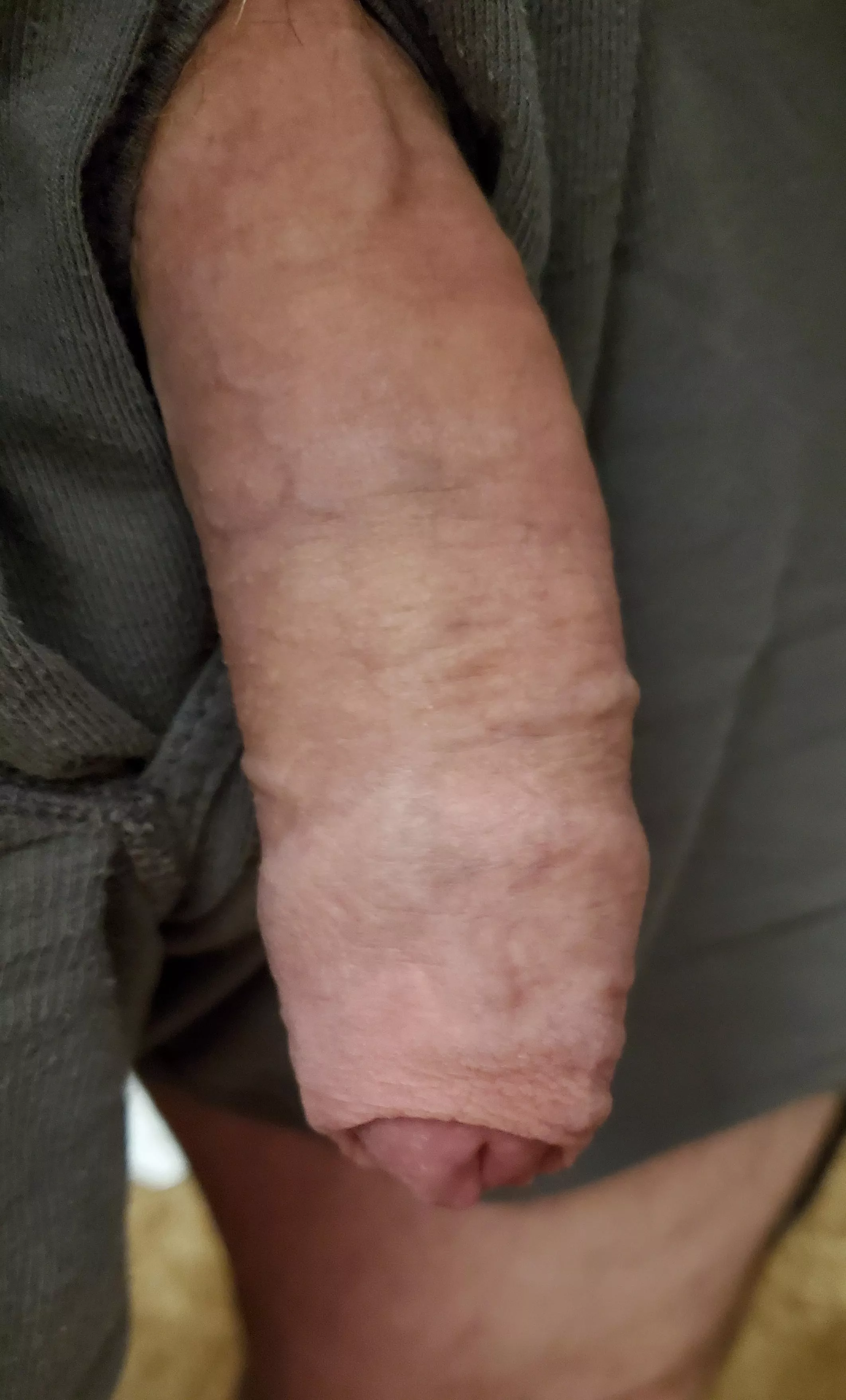 Luck the skin back for me.