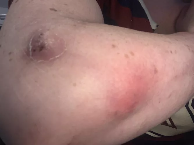 To pop or not to pop? Any advice/suggestions/comments/questions?