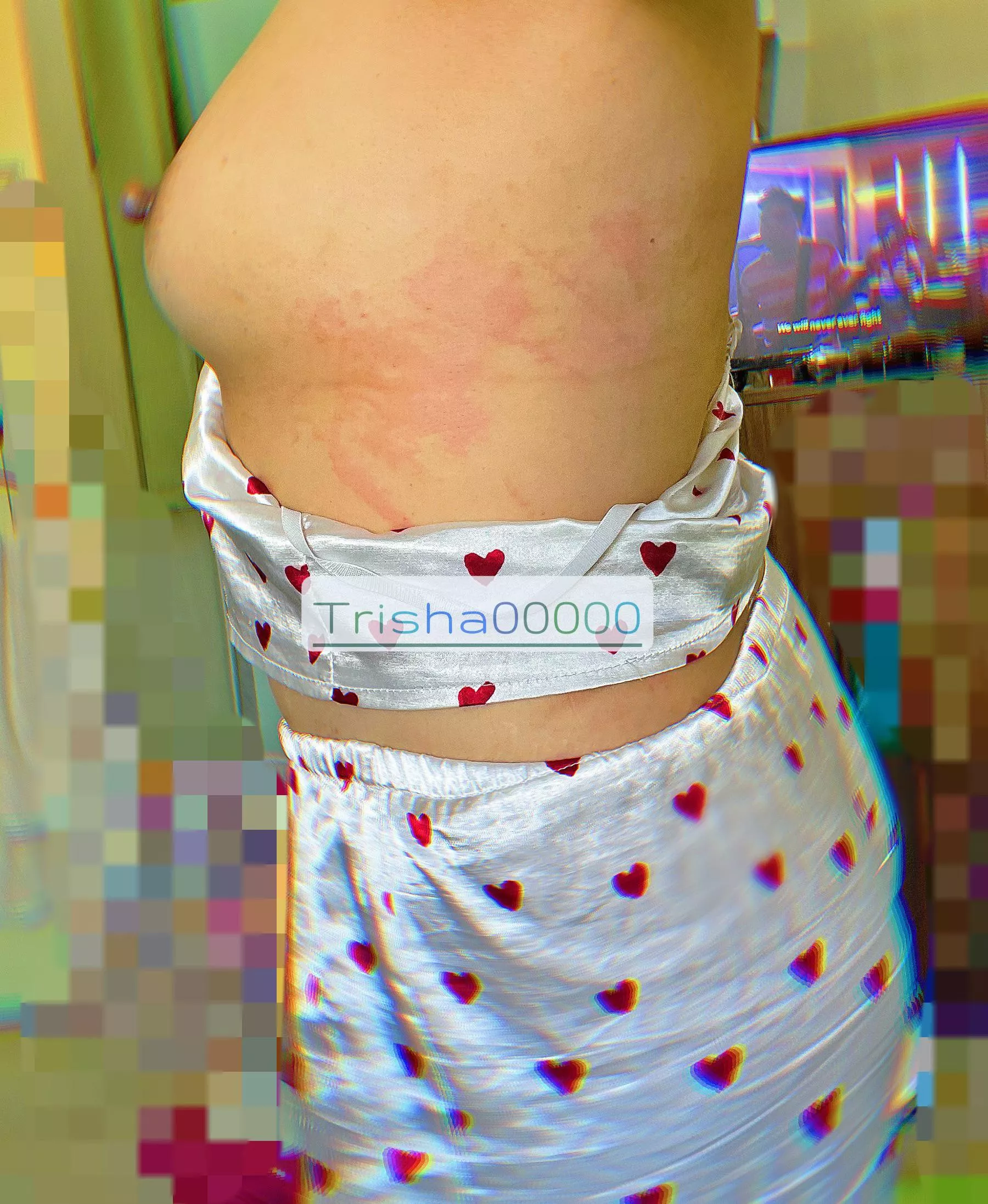 when you are hitted by an allergy 😢[f]