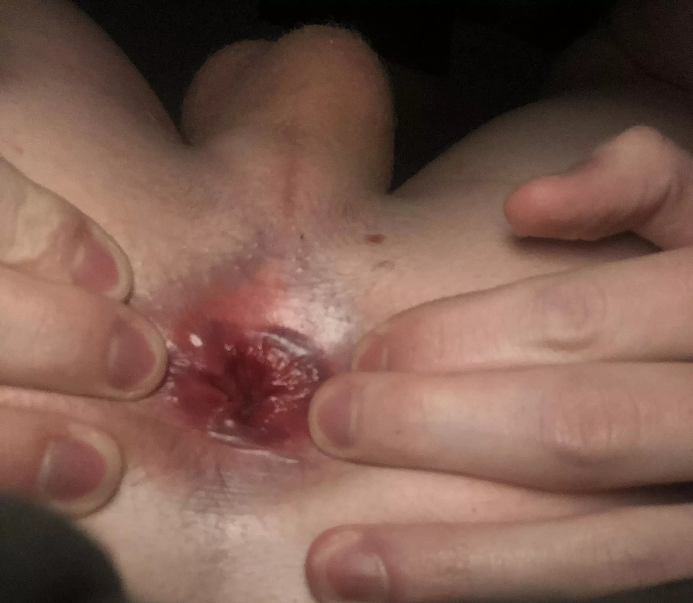 Anyone want to spread me further