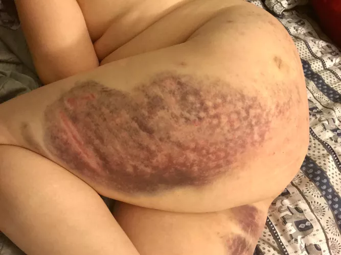 Some nice reminders from an impact scene [F]