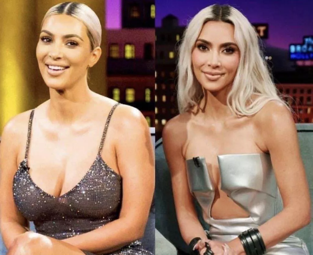 Did she get a breast reduction?