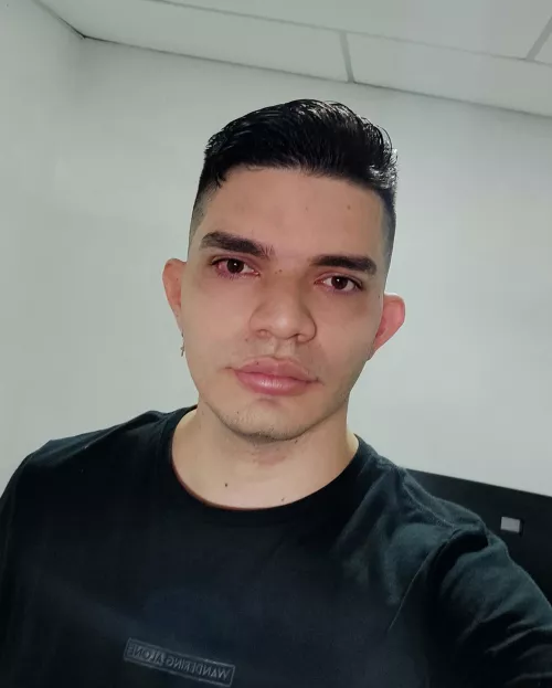 Fresh haircut and shampoo burning my eyes