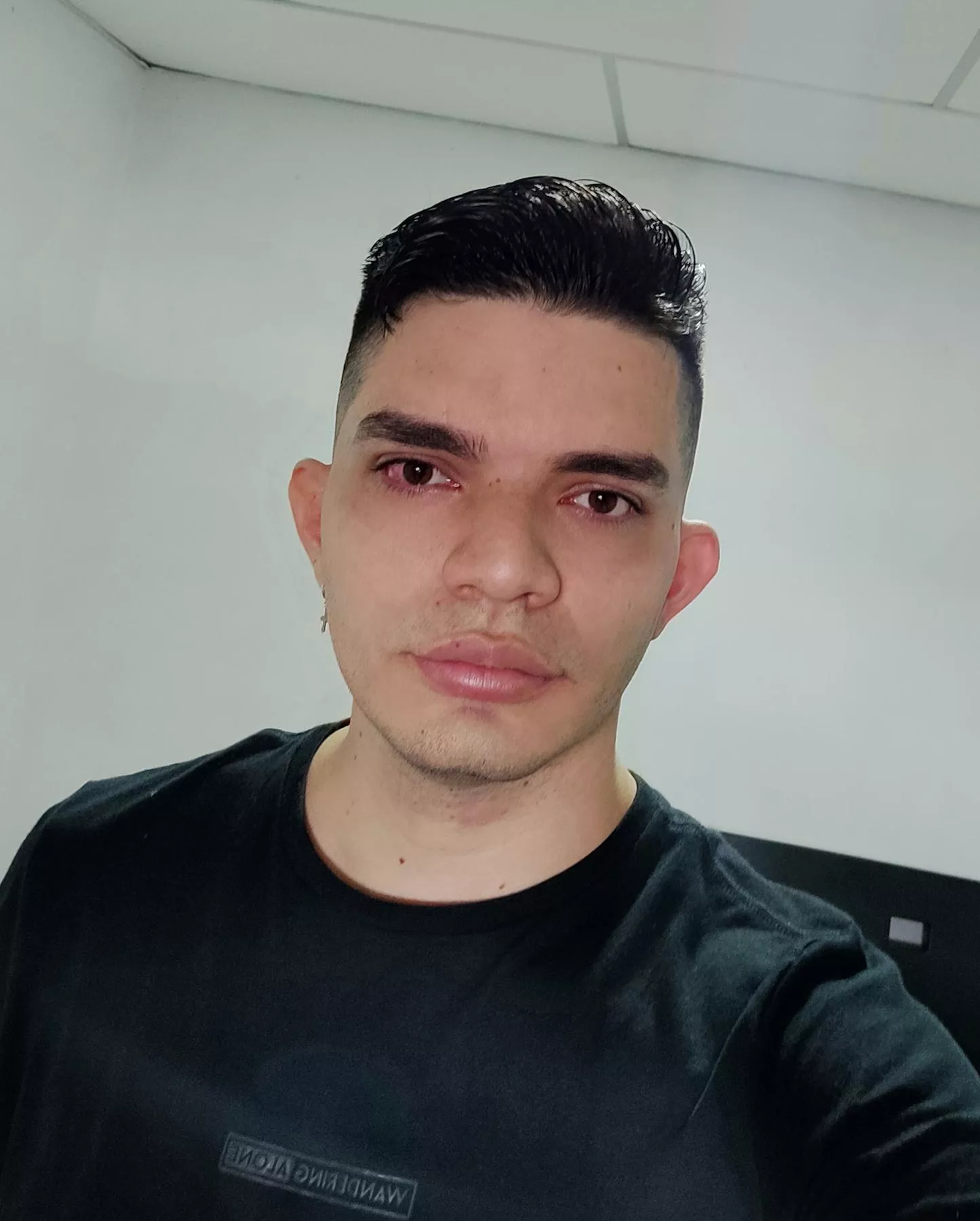 Fresh haircut and shampoo burning my eyes