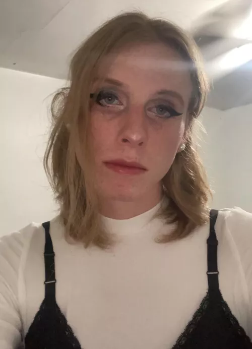 ignore the dark circles under my eyes^.^