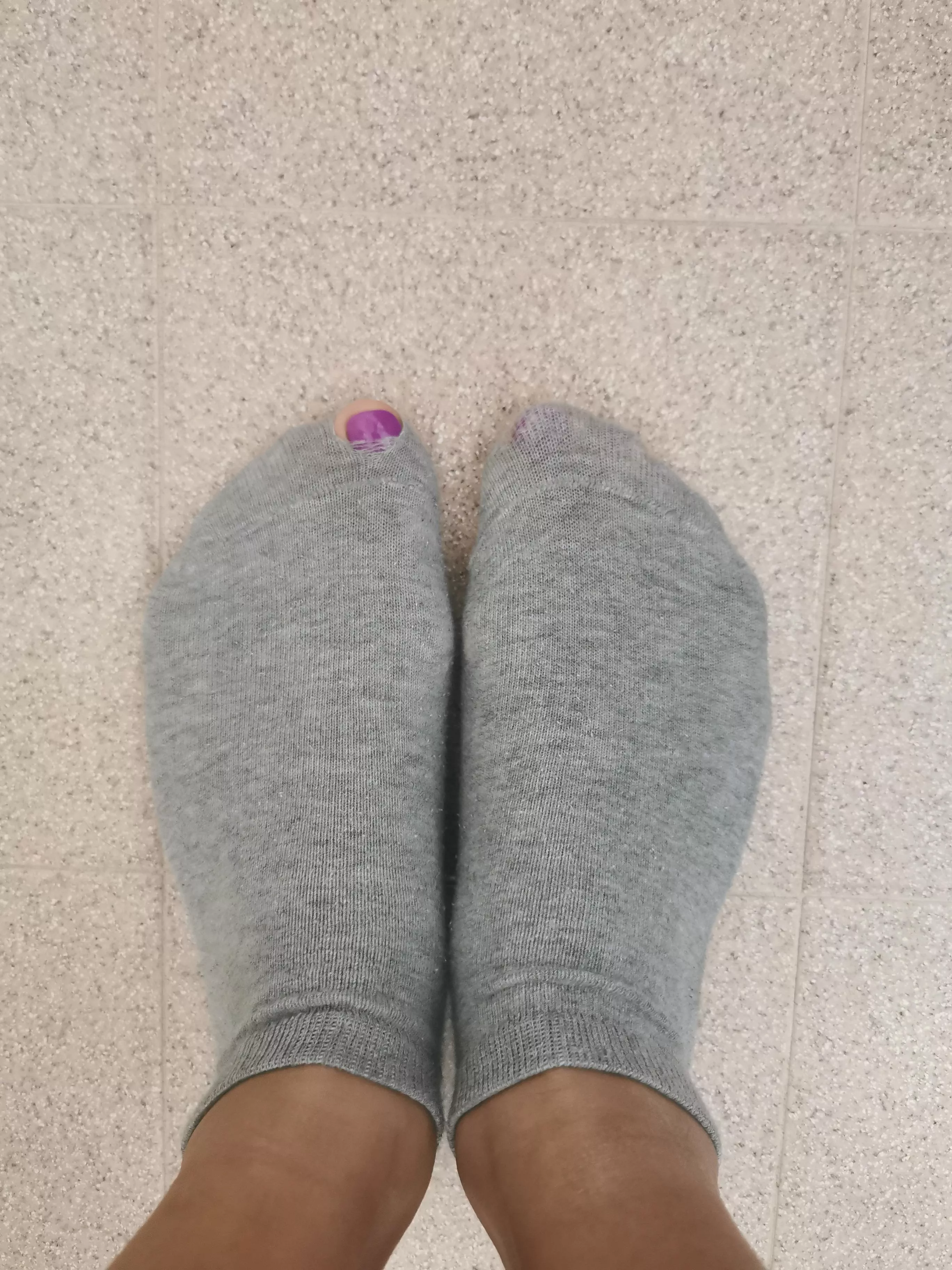 Ups...what do you think happened? 😏