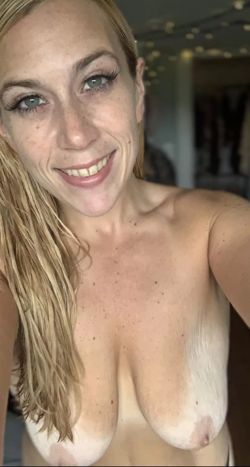 you don’t mind a few stretch marks do you? 🙈