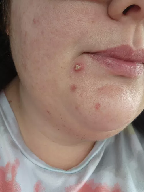 been dealing with this jerk for a couple weeks now, woke up to this cute lil thing