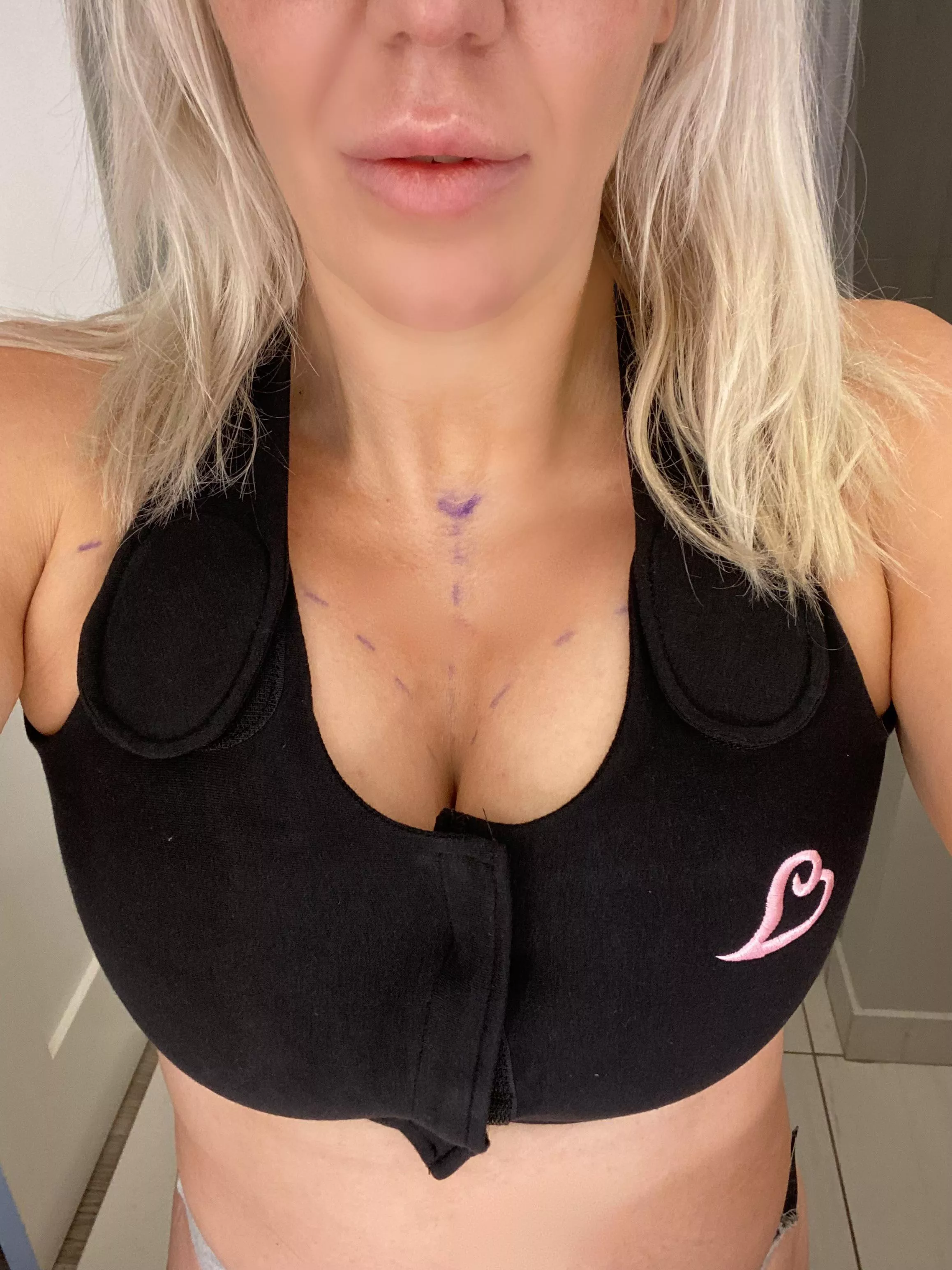 First boob job, 800cc expanders. I love them and they will only get bigger!