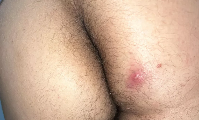Does this look infected?