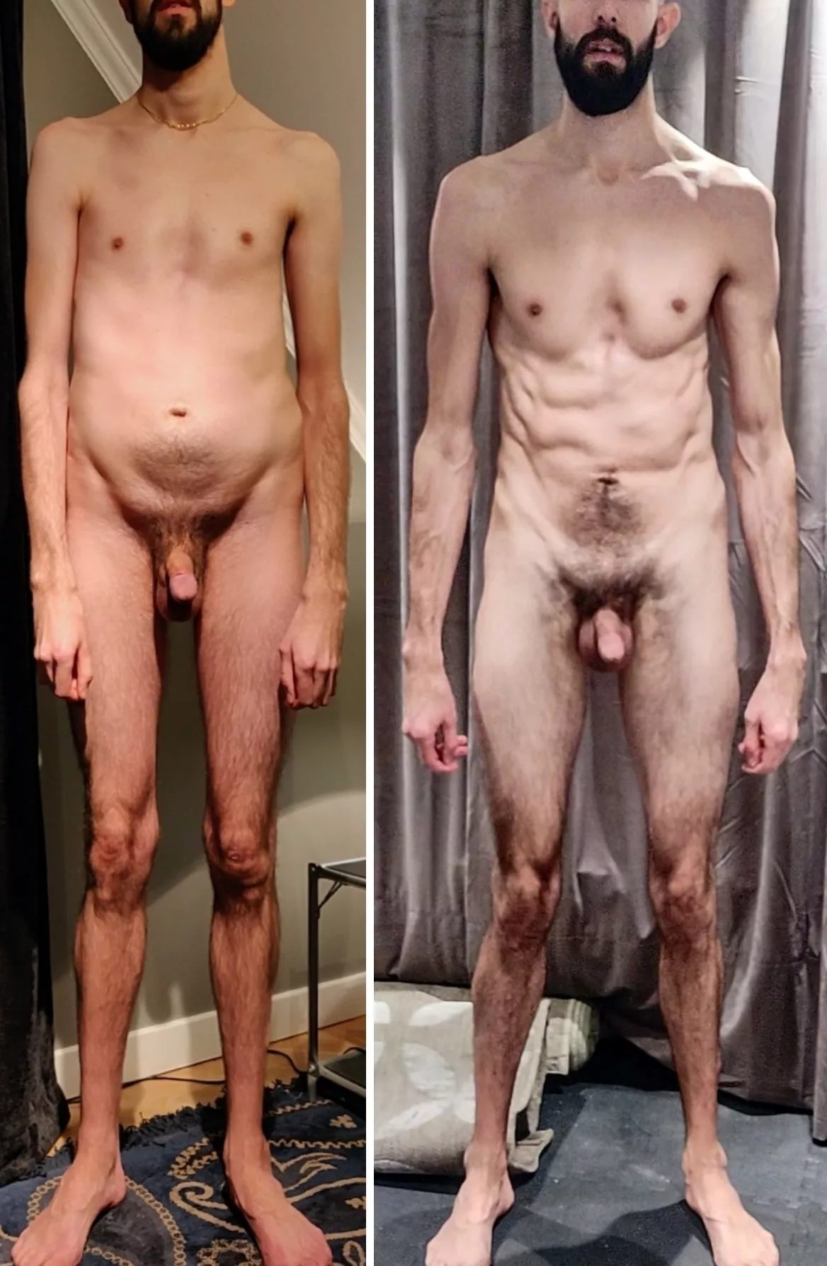 [M31, 70kg, 198cm] It's been 4 years since I decided to try and get in better shape to prepare for my pending heart surgery that I knew was coming, now it's almost here and this is where I'm at. (Marfan's syndrome nude journey update)