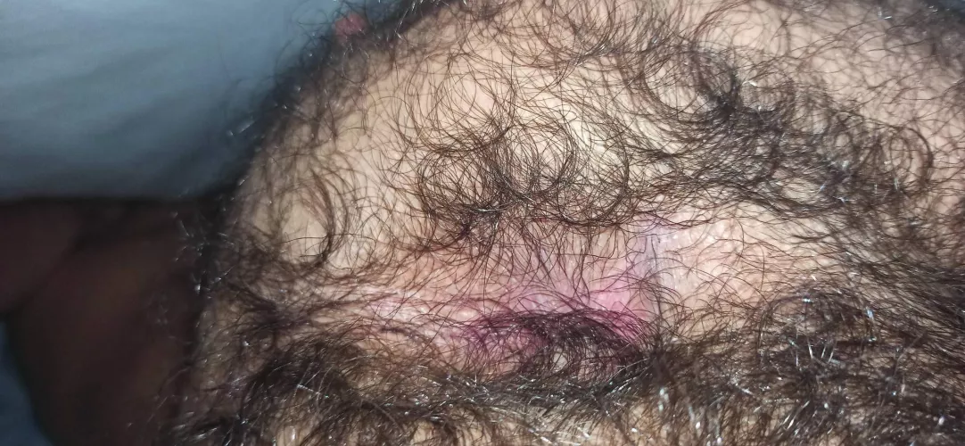 A suprise of what is under the fur