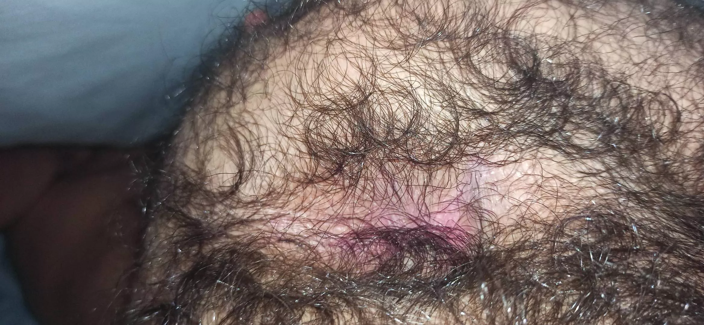 A suprise of what is under the fur