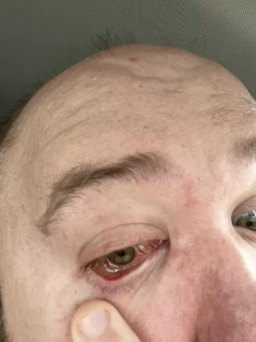 Forbidden Pop - Eyeball edition