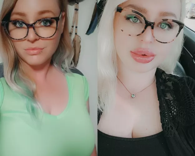 since someone posted my old before and after on here, figured I'd give you a slightly more updated version. 💉💋