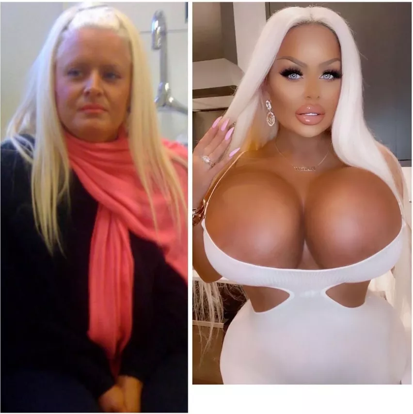 The power of the plastic surgeon