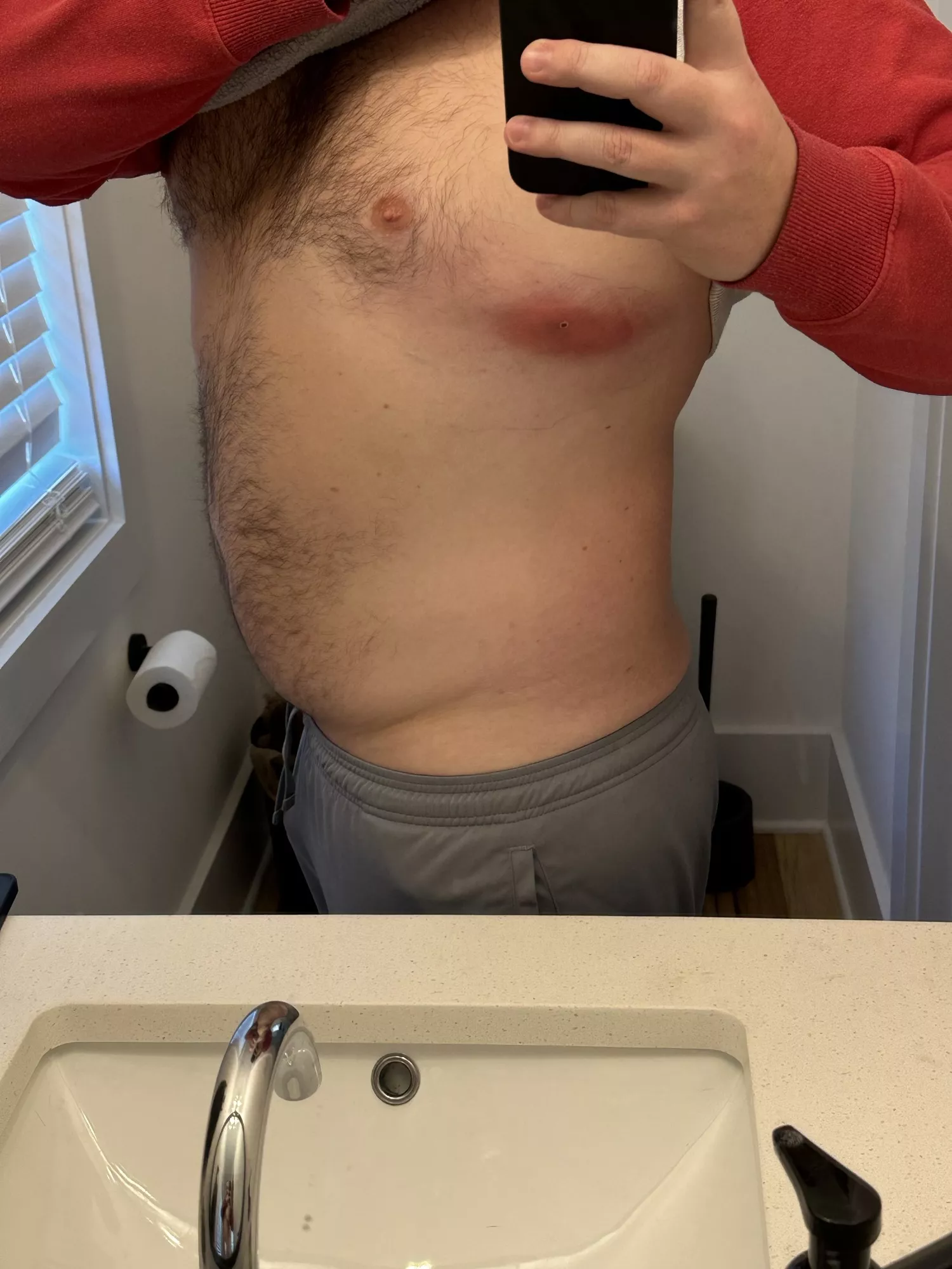 An infected bug bite. Its time is coming. Soon.