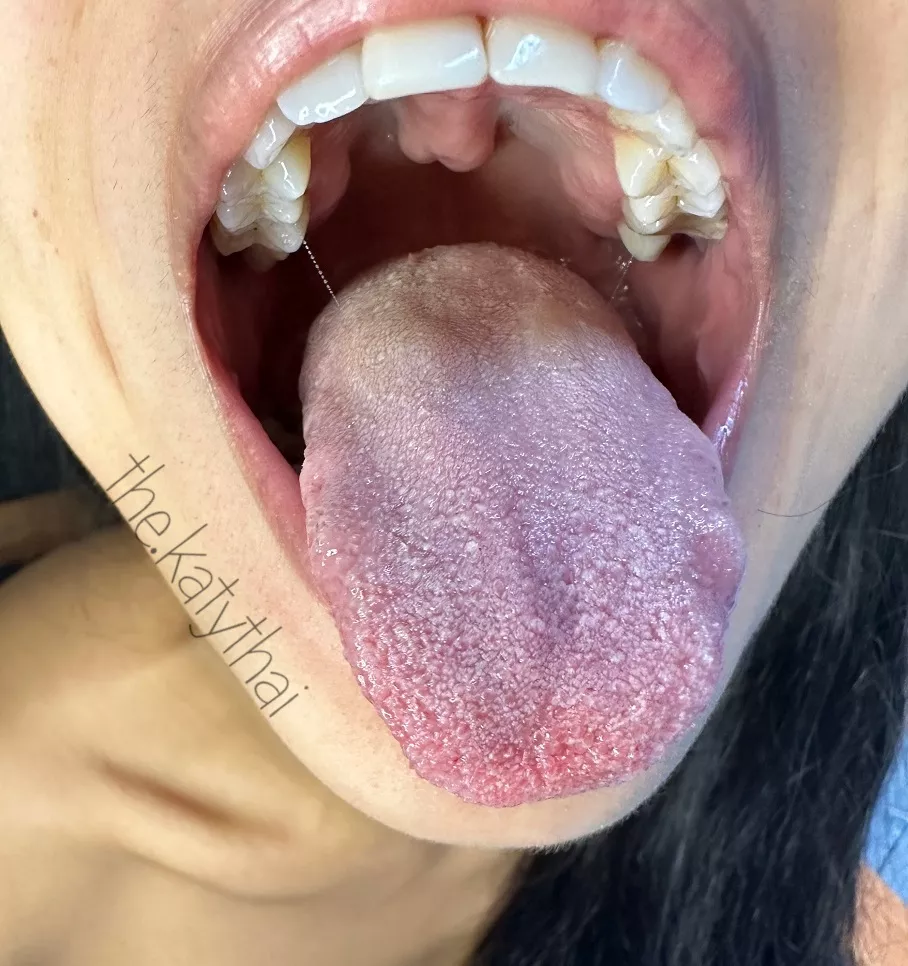 Any fans of Asian tongues?