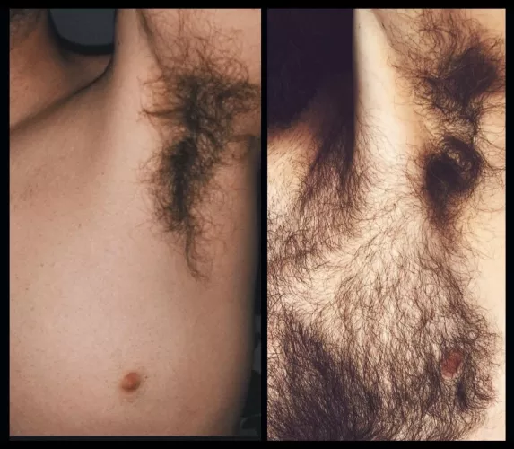 I used to shave my chest hair many years ago, but always kept my bushy pits untouched. They grew wild with my pubes during puberty at age 12 and have been turning everyone on ever since. (The left pic is c.2010 age 30, the right 2021, age 42)