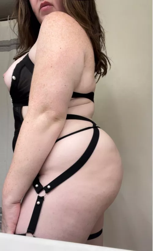 It's always freckles season