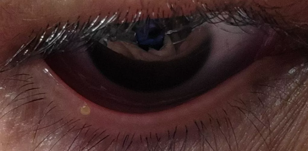What is this on my lower waterline?